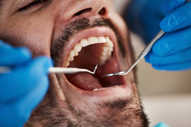 Best Walk-In Emergency Dentist in Seabrook Farms, NJ